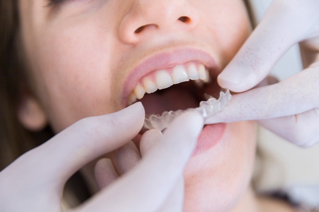 Napredni ortodontski izdelki