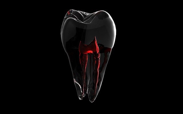 Endodontsko zdravljenje je rešitev ob vnetju zobnih tkiv globoko v koreninah zoba